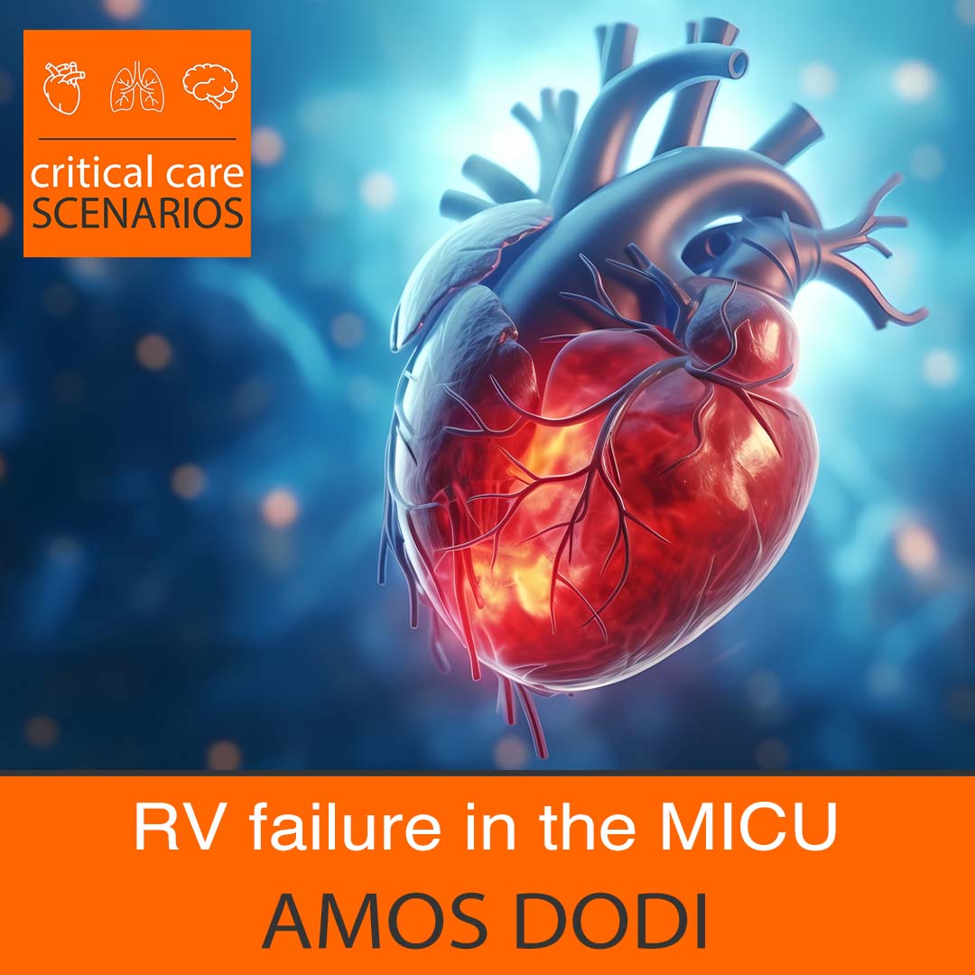 Episode 98: RV failure in the MICU